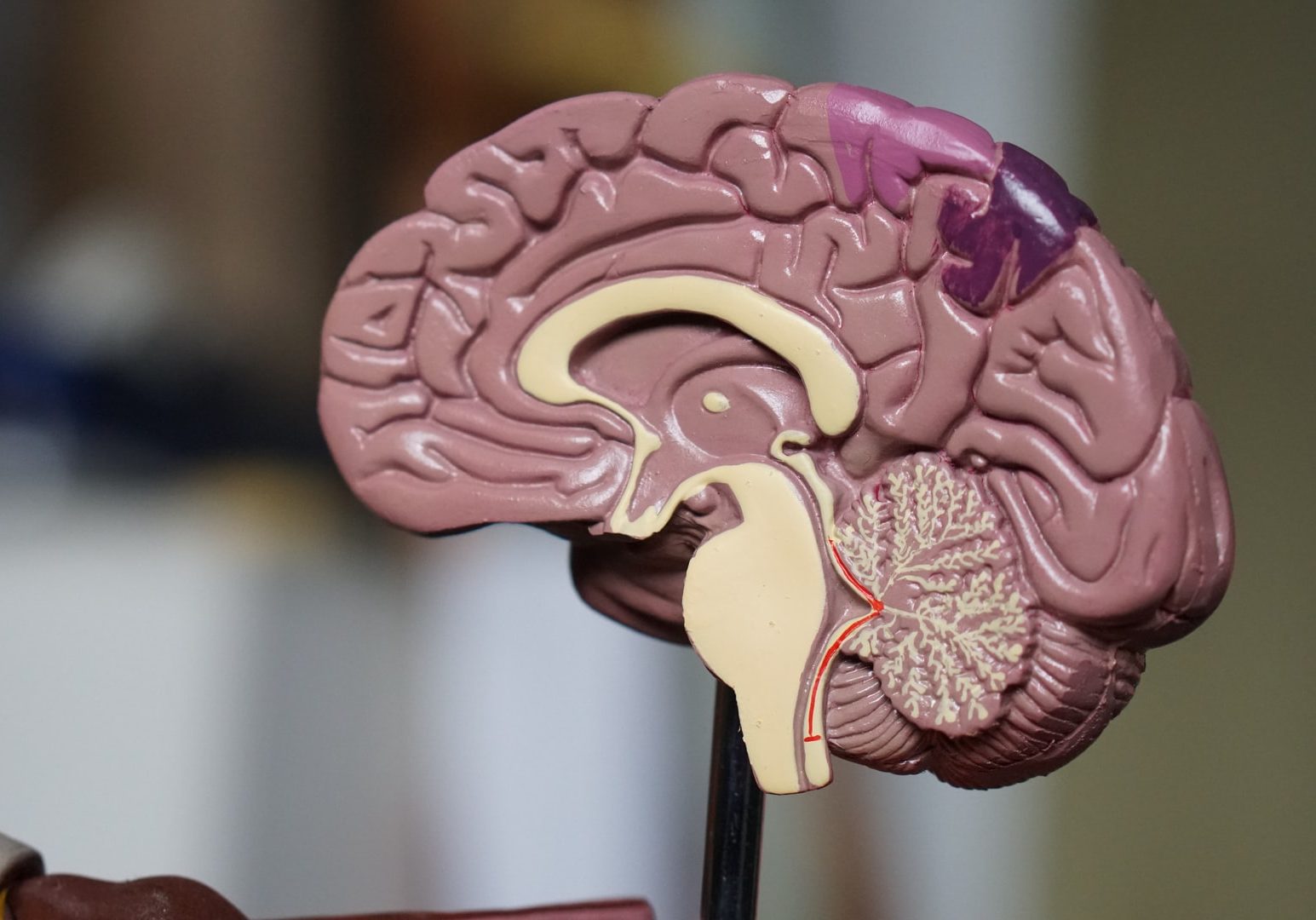 The Top 3 Causes of Traumatic Brain Injuries